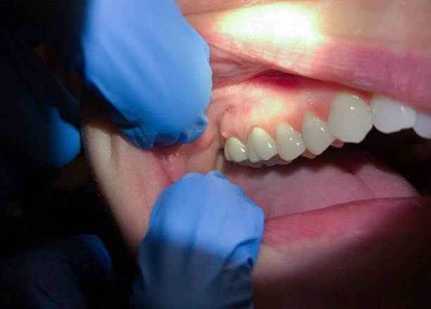 Best Emergency Tooth Extraction  in Potterville, MI